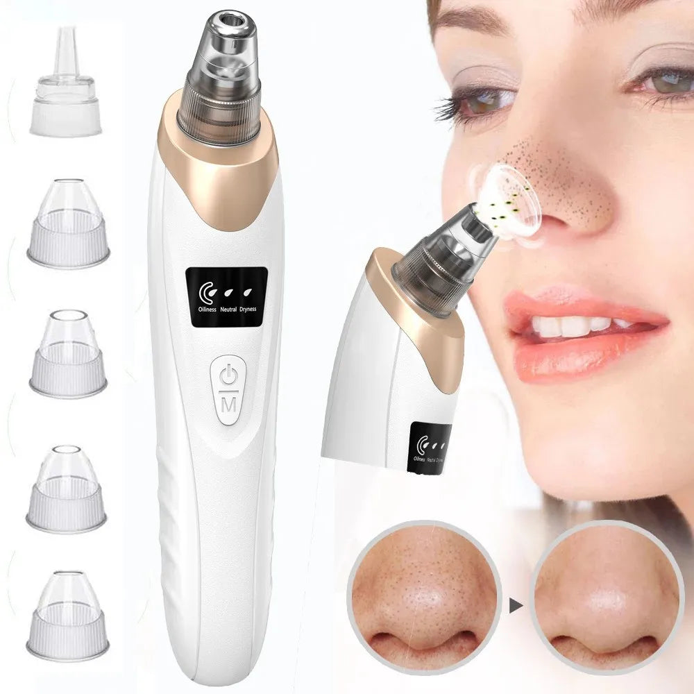 ✨ PoreClean™ – Extractor Eléctrico de Puntos Negros para el Rostro